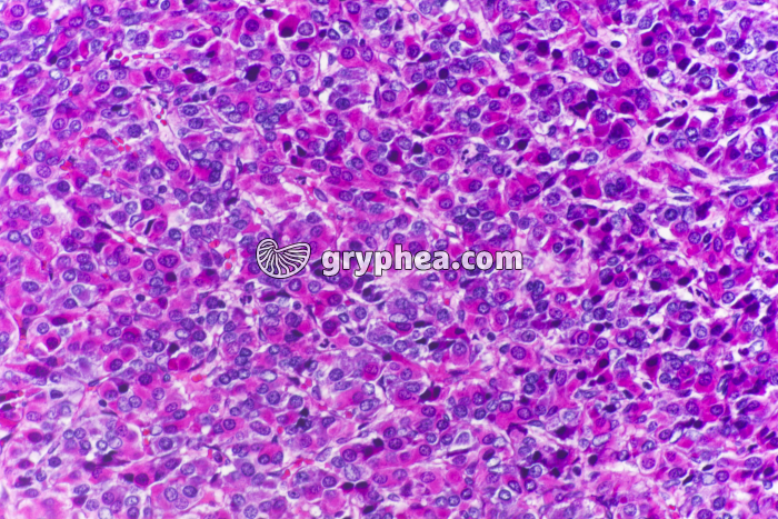 Hypophyse antérieure x100 - gryphea.com